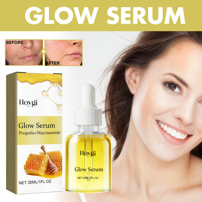 Hoygi Glow Serum, Moisturizing And Whitening Skin To Reduce Facial Spots And Fine Lines